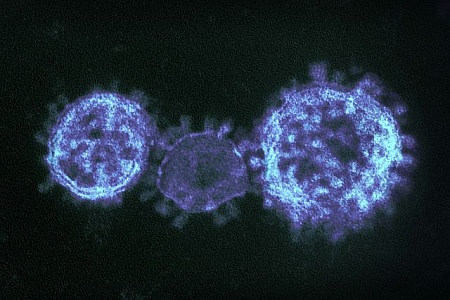 coronavirus-under-electron-microscope[1]